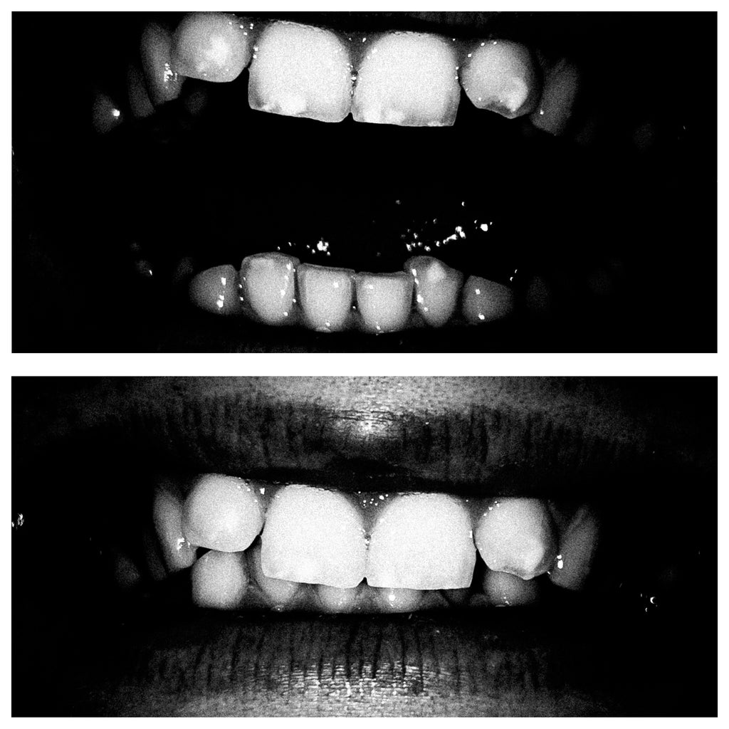 Specimen 1 - White Teeth t-shirt